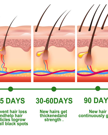Rosmarin Anti-Bruch Pflegende Haarpflege Öl - ellashop.store