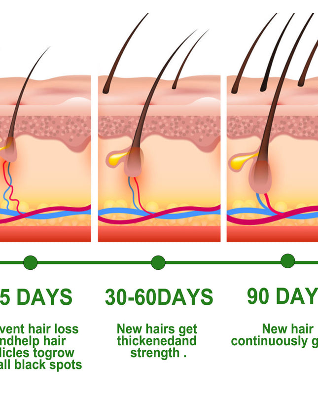 Rosmarin Anti-Bruch Pflegende Haarpflege Öl - ellashop.store