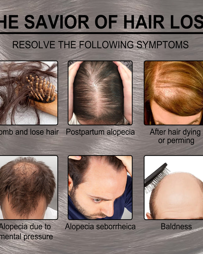 Rosmarin Anti-Bruch Pflegende Haarpflege Öl - ellashop.store